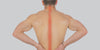 Arthritis in Back - Spinal Arthritis Overview