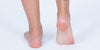 Flat Feet - What You Need to Know