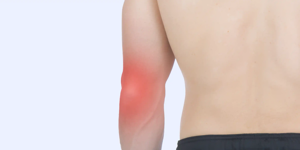 Hyperextended Elbow Pain — Vive Health
