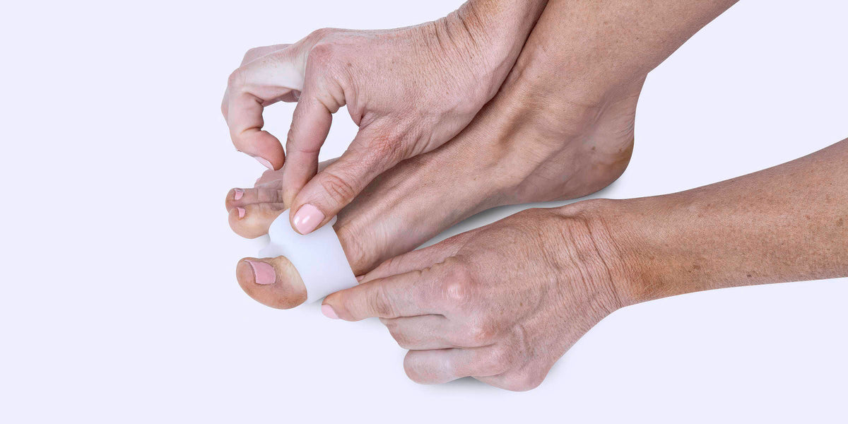 How to Prevent Bunions Before They Get Worse — Vive Health