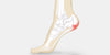 Heel Pain - The Complete Injury Guide
