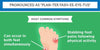 Plantar Fasciitis Insoles [Ultimate Guide + Infographic]