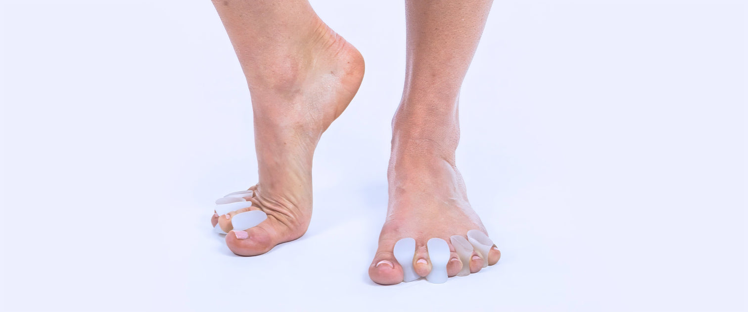 Overstretched Toes How to Straighten Overlapping Toes & Reduce Pain — Vive Health