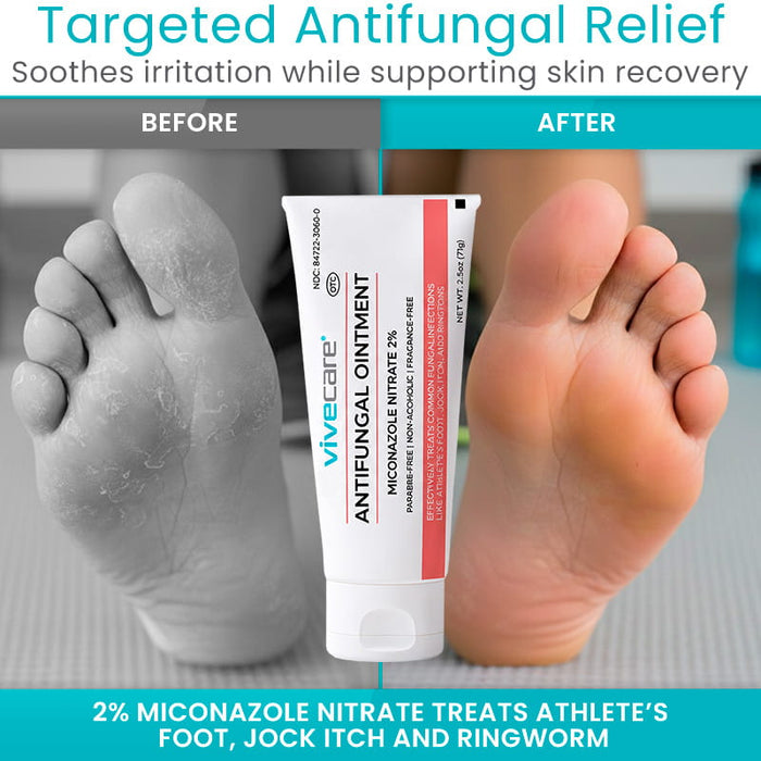 Targeted Antifungal Relief
