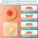 Adapts to Different Stomas