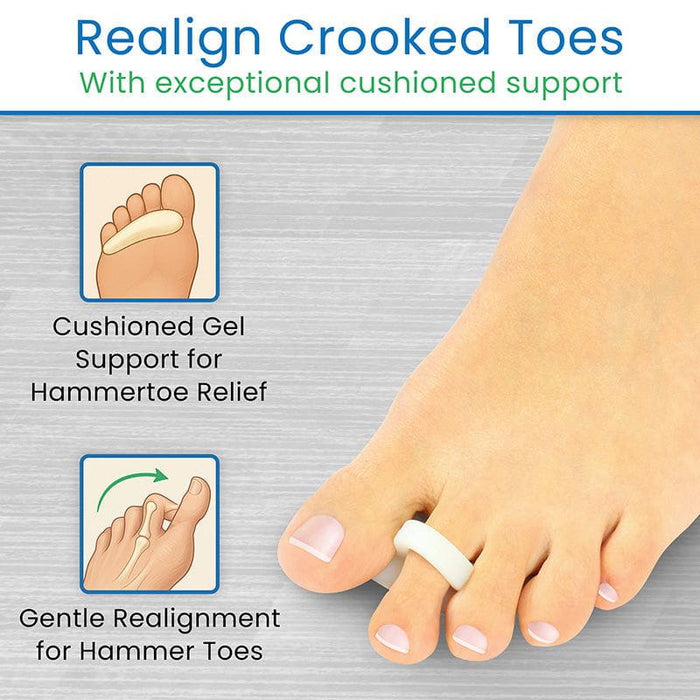 Realign Crooked Toes