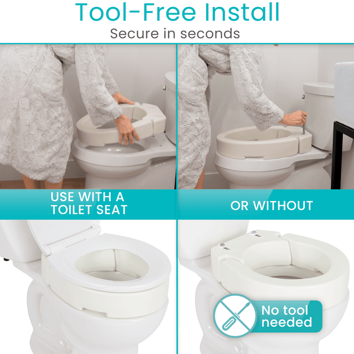 Tool-Free Installation