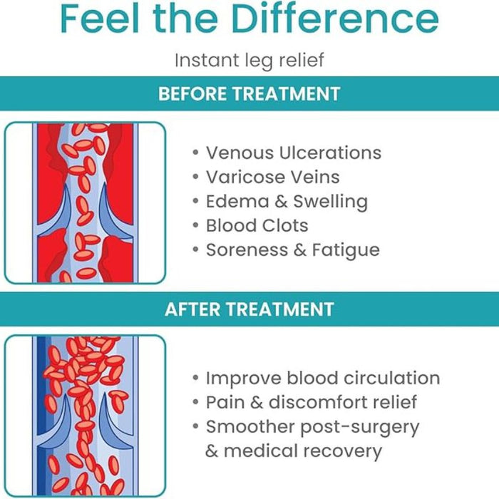 15-20 Thigh High Compression Stockings