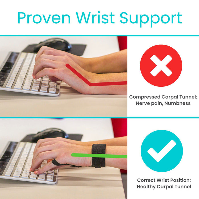 Nerve Pain Hand Exercises To Avoid Carpal Tunnel Tunnel Tamer