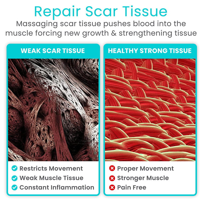 Repair Scar Tissue