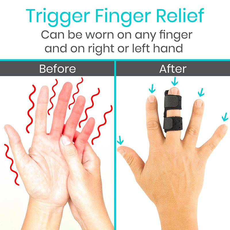 Terminalization Finger Trigger Finger Splint